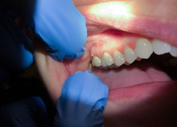 Best Teeth Whitening  in Altavista, VA